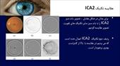 تاثیر تقویت تصویر مبتنی بر تکنیک  ICA  در تقسیم بندی عروق خونی شبکیه چشم